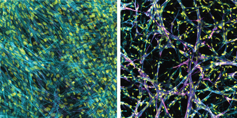 2-D and 3-D lung tissue