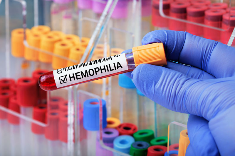 Children’s Hospital Administers First Commercially Available Gene Therapy for Hemophilia B