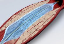 Medical Equipment Giant Stryker Acquires Boston Company for $835M Artery
